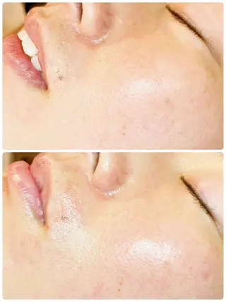 多摩境ViVi chinamiのエステ・リラクイメージ