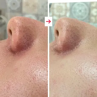 たるみ改善小顔エステ 堀葉月のその他イメージ