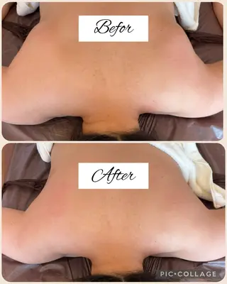 筋膜リリースサロン Embellirのエステ・リラクイメージ