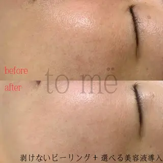 歌舞伎町深夜サロン to mëのエステ・リラクイメージ
