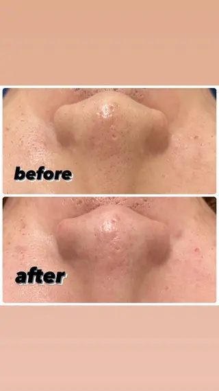 A/S アズのエステ・リラクイメージ