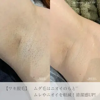 脱毛&ビューティー A'nJUDYの眉毛・アイブロウイメージ