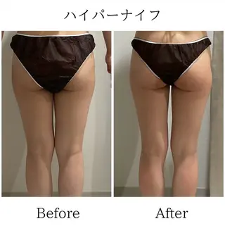 LiLL 熊本のエステ・リラクイメージ