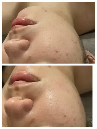 アロマオイルリンパ マッサージ💆‍♀️のエステ・リラクイメージ