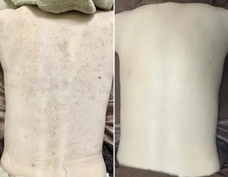 NOBLE 新宿南口店のエステ・リラクイメージ