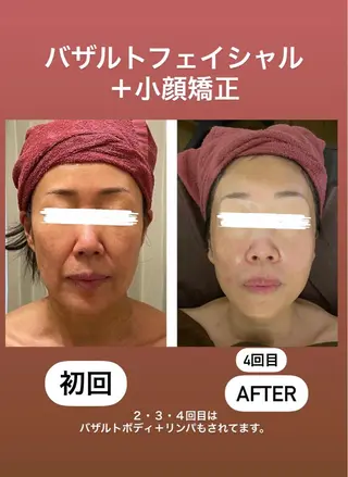 35歳からの エイジングケアサロンのエステ・リラクイメージ