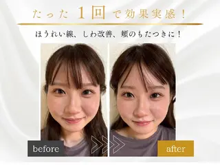 ハーブピーリング横浜 肌質改善専門店のその他イメージ