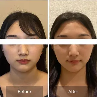 柳瀬 絵美のマツエク・マツパデザイン