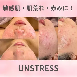 肌質改善サロン ココマヒナのエステ・リラクイメージ