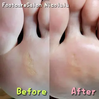 足トラブル専門 ニコルル金沢のエステ・リラクイメージ