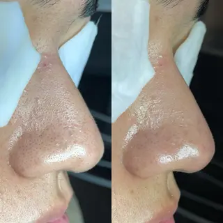 Re:Belle 久留米 : 中島のエステ・リラクイメージ