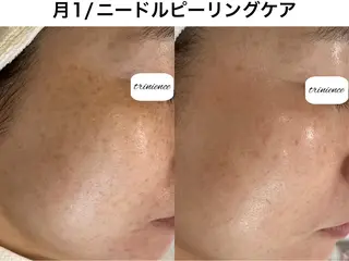 TRINIENCE 南流山店のエステ・リラクイメージ