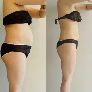 Re:Oasis所属・🦋痩身専門サロン Re:oasis🦋のエステ・リラクイメージ