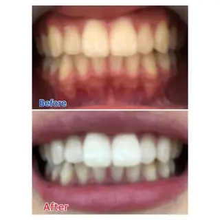 Ｍ渋谷 ホワイトニングのエステ・リラクイメージ