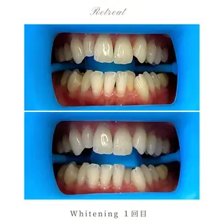 歯科医院提携 Retreatのエステ・リラクイメージ