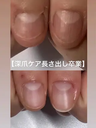 メンズ ネイル 爪ケア/深爪 自爪育成 🐰えむのネイルデザイン