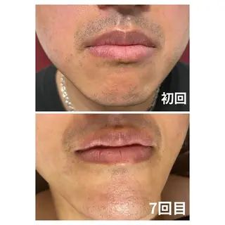 メンズ エマニエル USAのエステ・リラクイメージ