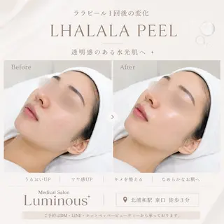 【医療提携エステ】 ルミナス北浦和のエステ・リラクイメージ