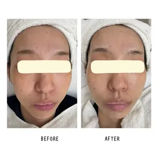 Yoshino Erinaのエステ・リラクイメージ