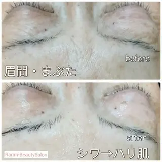 若返り 美肌   エステサロンららんのエステ・リラクイメージ