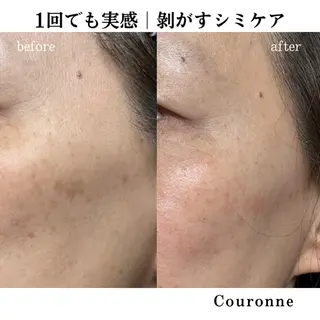 シミ・毛穴ケア専門 クロヌYUKIのエステ・リラクイメージ