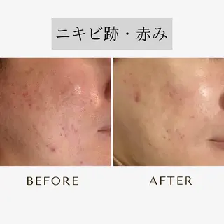 ICHOOSE/ 代々木上原のエステ・リラクイメージ