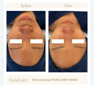 艶肌ワックス ALLY.のエステ・リラクイメージ