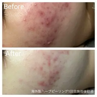 深い肌悩み専門 フェイシャルサロンのエステ・リラクイメージ