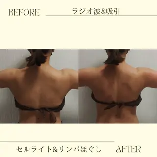 痩身小顔専門 アマテ ビューティー.Nのエステ・リラクイメージ