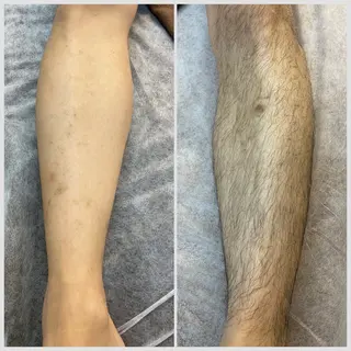 メンズ メンズ脱毛 ビーグラッド神戸三宮のエステ・リラクイメージ