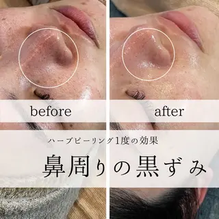 yc.hacci 【ハーブピーリング】の眉毛・アイブロウイメージ