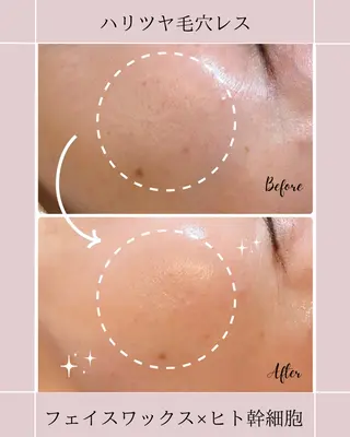 Detox Salon〜Lani Blue〜所属・土田 遥菜のエステ・リラクイメージ