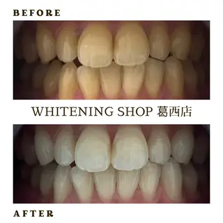 メンズ ホワイトニング ショップ葛西店のその他イメージ