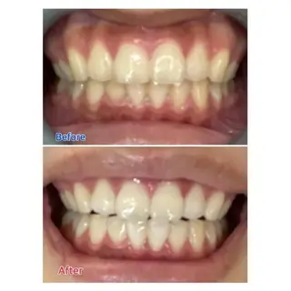 Ｍ渋谷 ホワイトニングのエステ・リラクイメージ