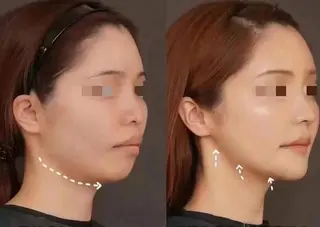 ショート カラー パーマ ネイル マツエク・マツパ aliaハーブ水光店 エステティシャン募集のエステ・リラクイメージ