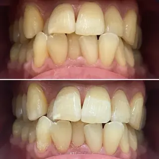 メンズ whiteclub THREEのその他イメージ