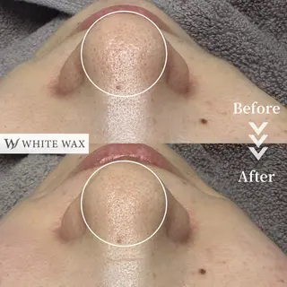 フェイシャルワックス KANAKOのエステ・リラクイメージ