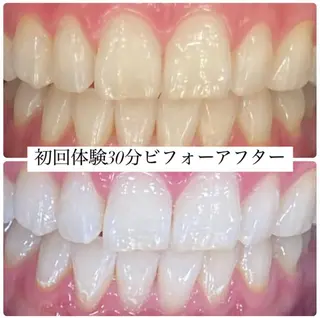 ホワイトニングルーム 横浜店のその他イメージ