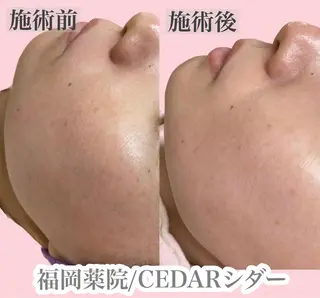 【薬院】まつげ 眉毛のマツエク・マツパデザイン