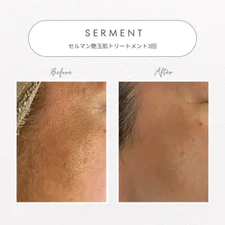 beaute LABO所属・大宮肌管理サロン sayakaのエステ・リラクイメージ