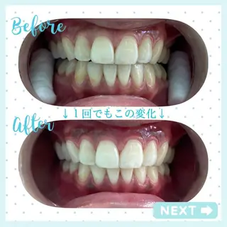 セルフホワイトニング COCOSHIROのエステ・リラクイメージ