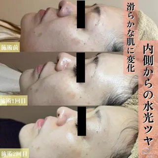 アイミー 森田のエステ・リラクイメージ