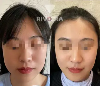 マツエク・マツパ aliaハーブ水光店 エステティシャン募集のエステ・リラクイメージ