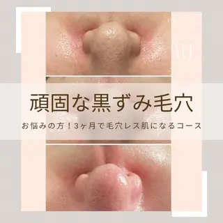 1ヶ月後も半分残る 高持続LEDエクステのマツエク・マツパデザイン