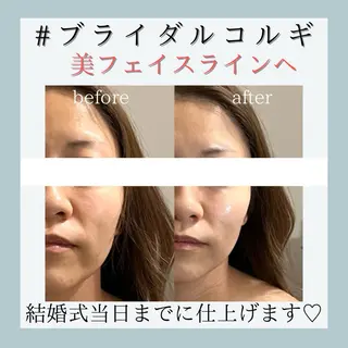 小嶋萌 今池駅徒歩2分のエステ・リラクイメージ