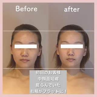 小顔矯正専門店Gémiey所属・越谷駅徒歩３分 小顔専門Gemieyのエステ・リラクイメージ