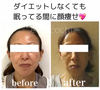 小顔と ヘッドスパのお店のエステ・リラクイメージ