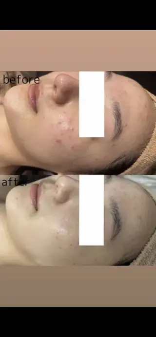 🧸レイビス💕 sora🧸のエステ・リラクイメージ