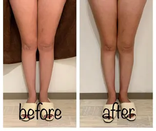 リンパマッサージ mimozaのエステ・リラクイメージ