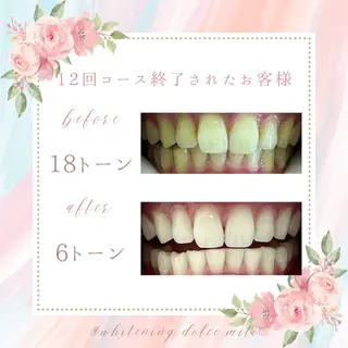 セルフホワイトニング Dolce八王子店のその他イメージ